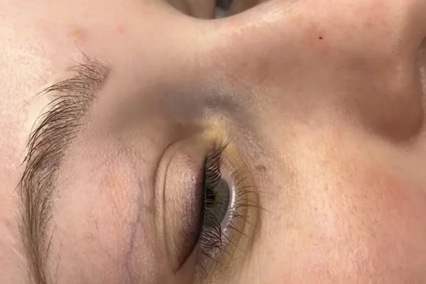 Permanent makeup
