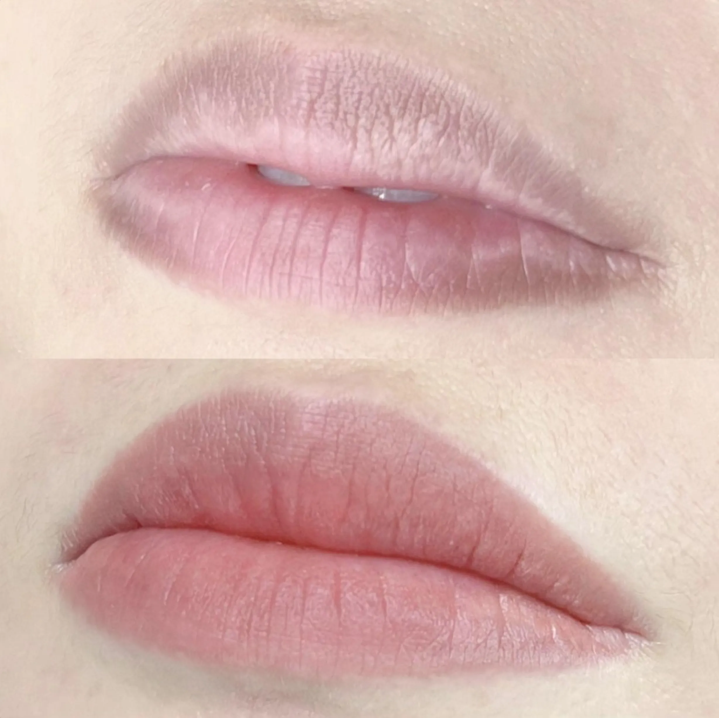 dental appointment after lip tattoo