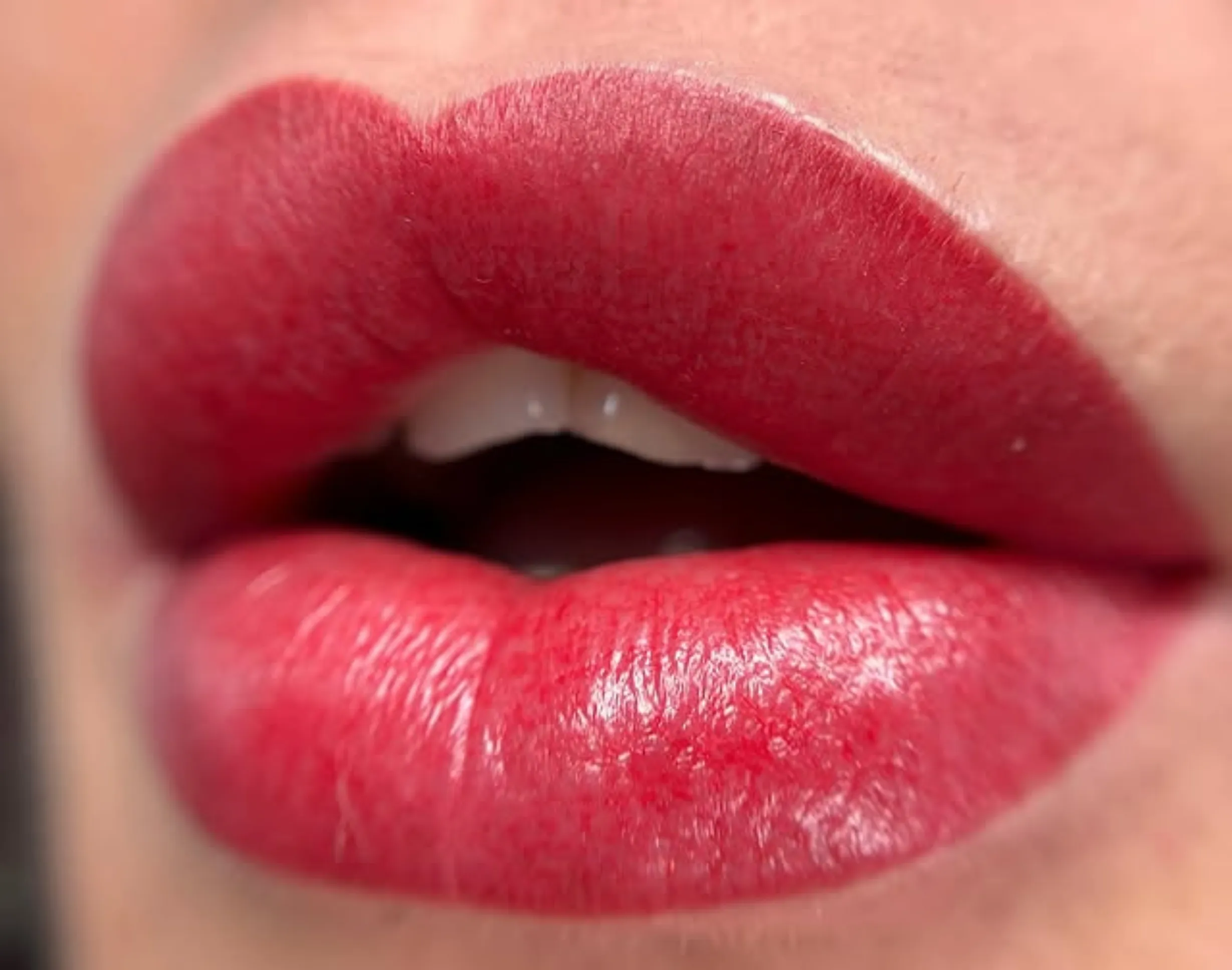lip tattoo healing and dental work