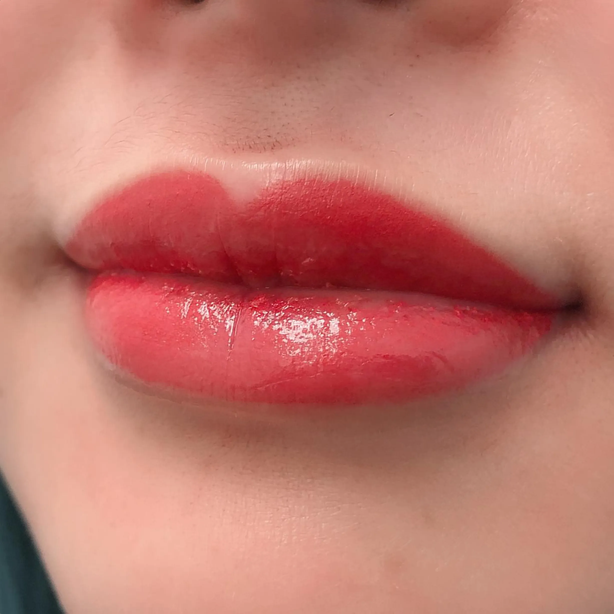 risks of dental work after lip tattoo
