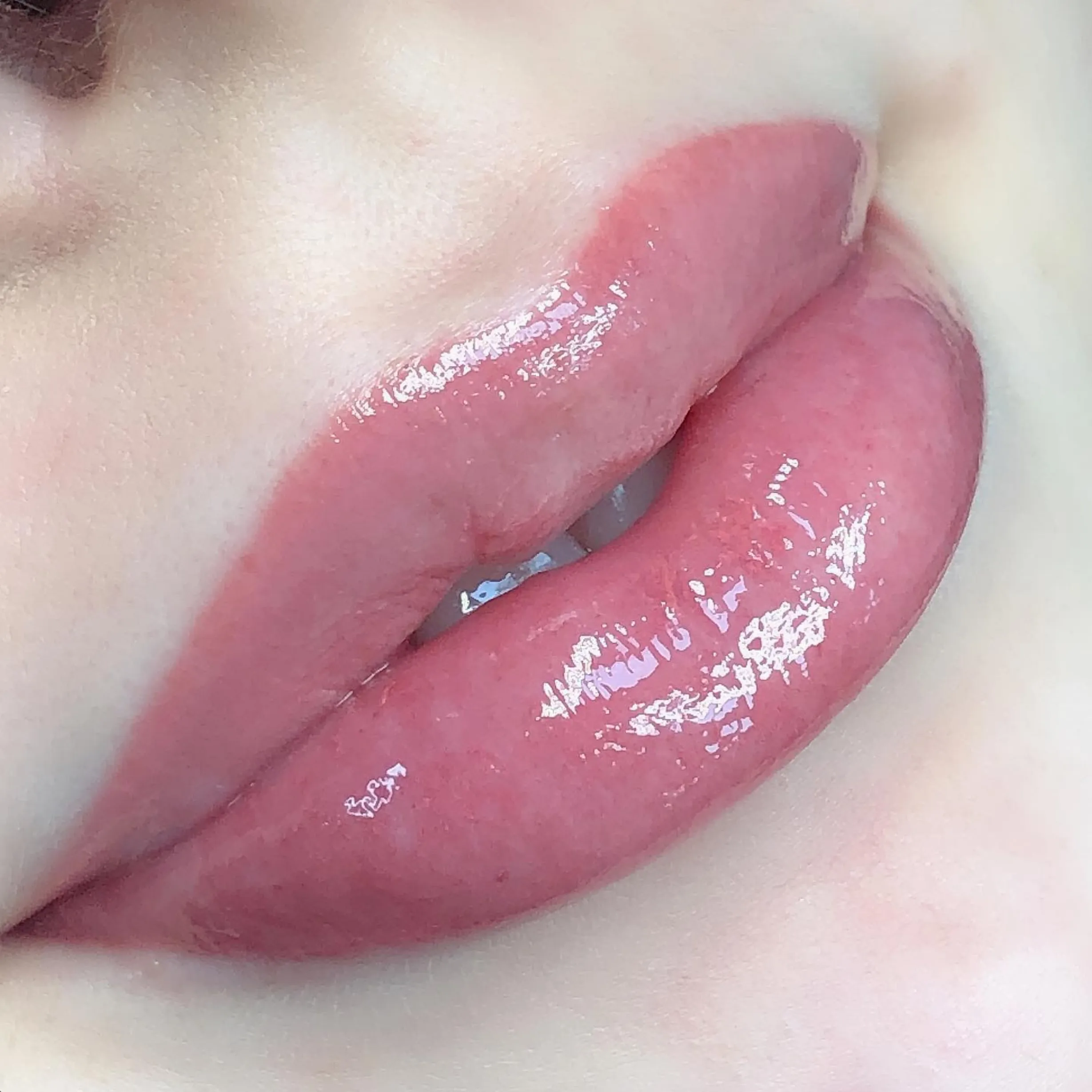 when to see dentist after lip tattoo