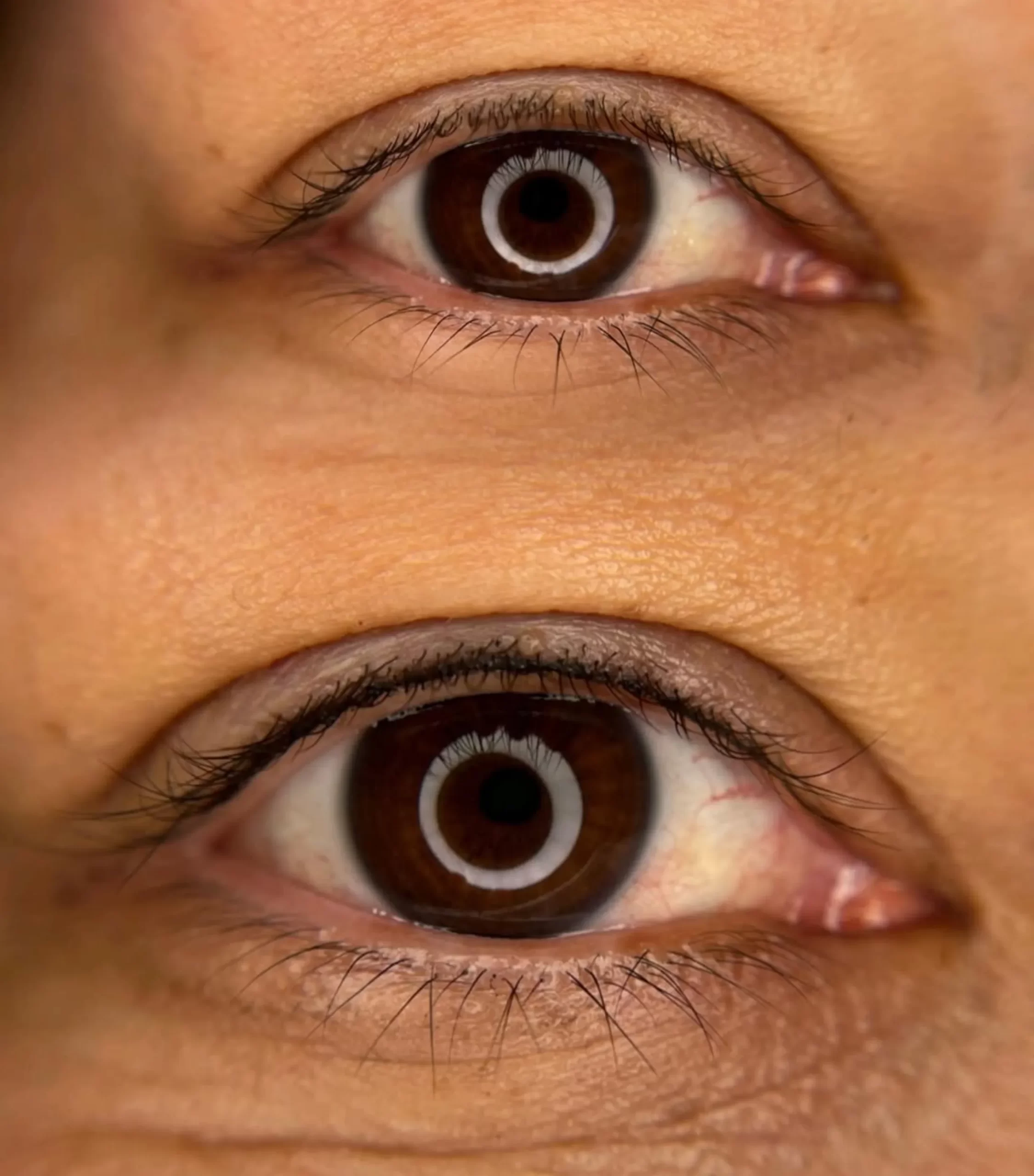 lash tattoo pigment migration