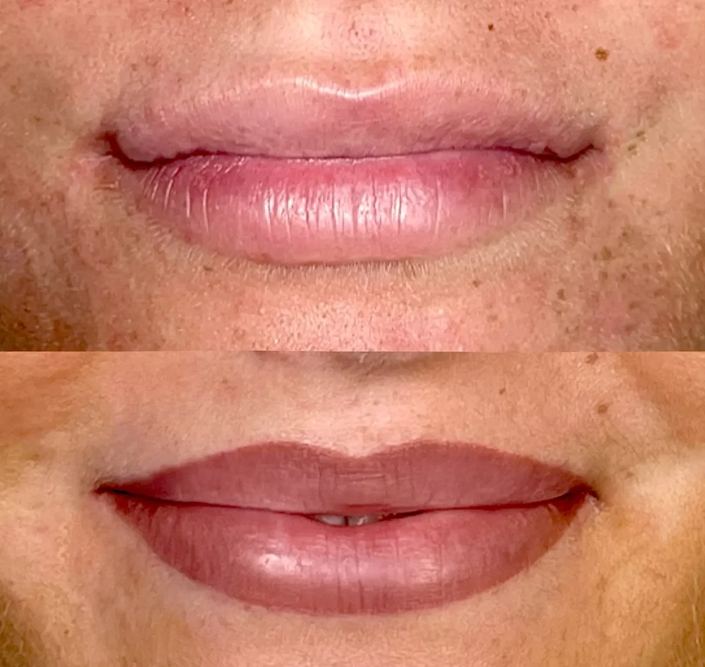 Who Does This Treatment Work Beautifully For