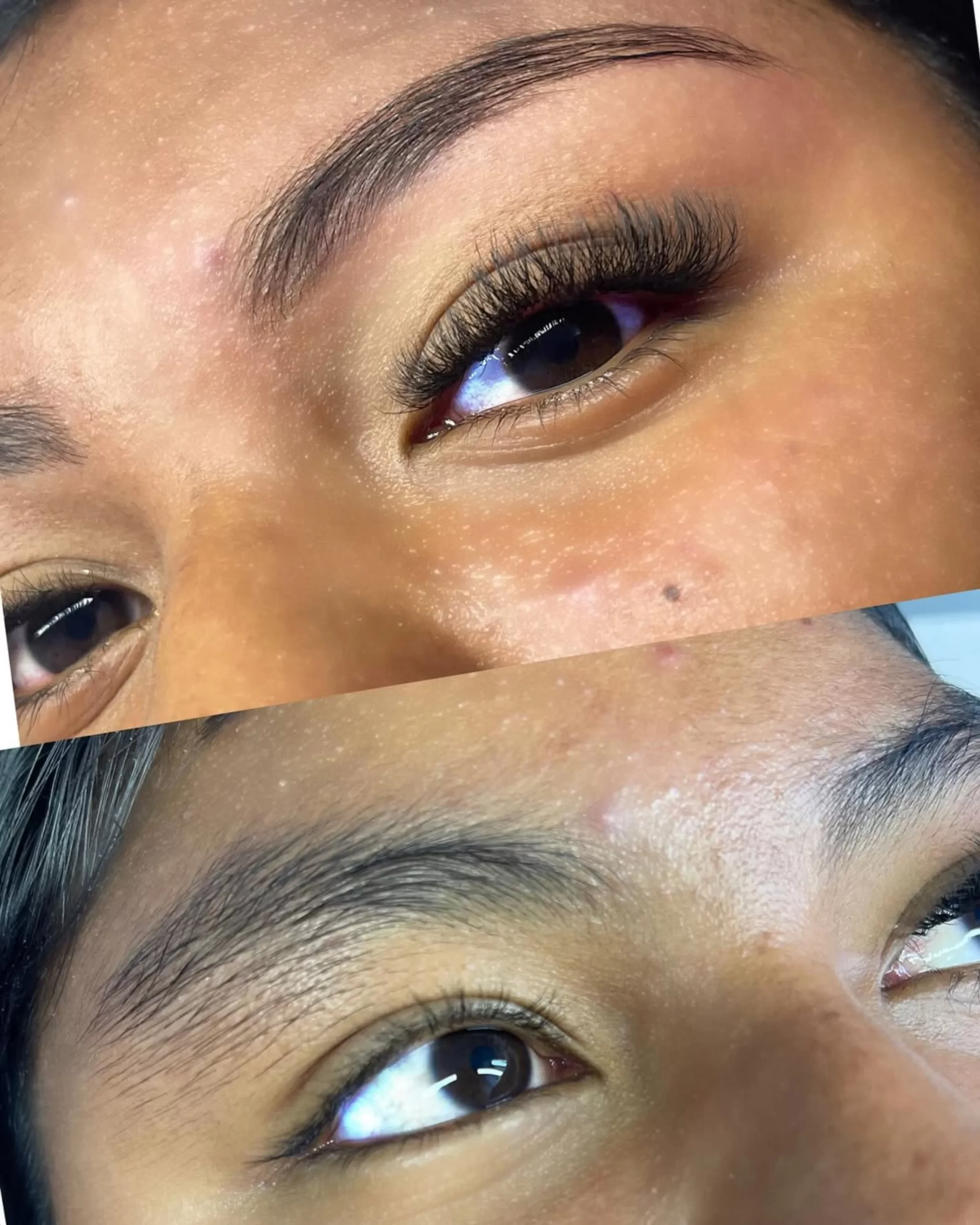 niacinamide skin barrier repair