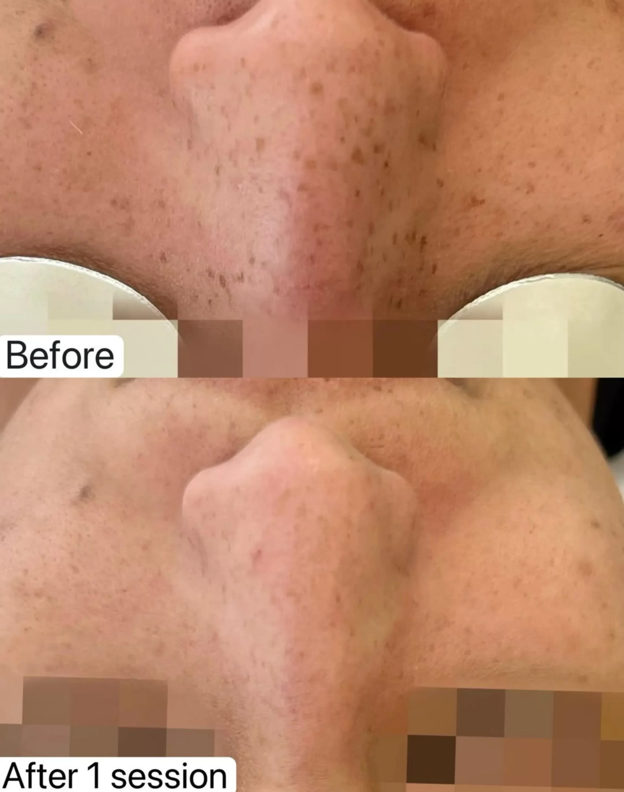 vitamin C for skin studies